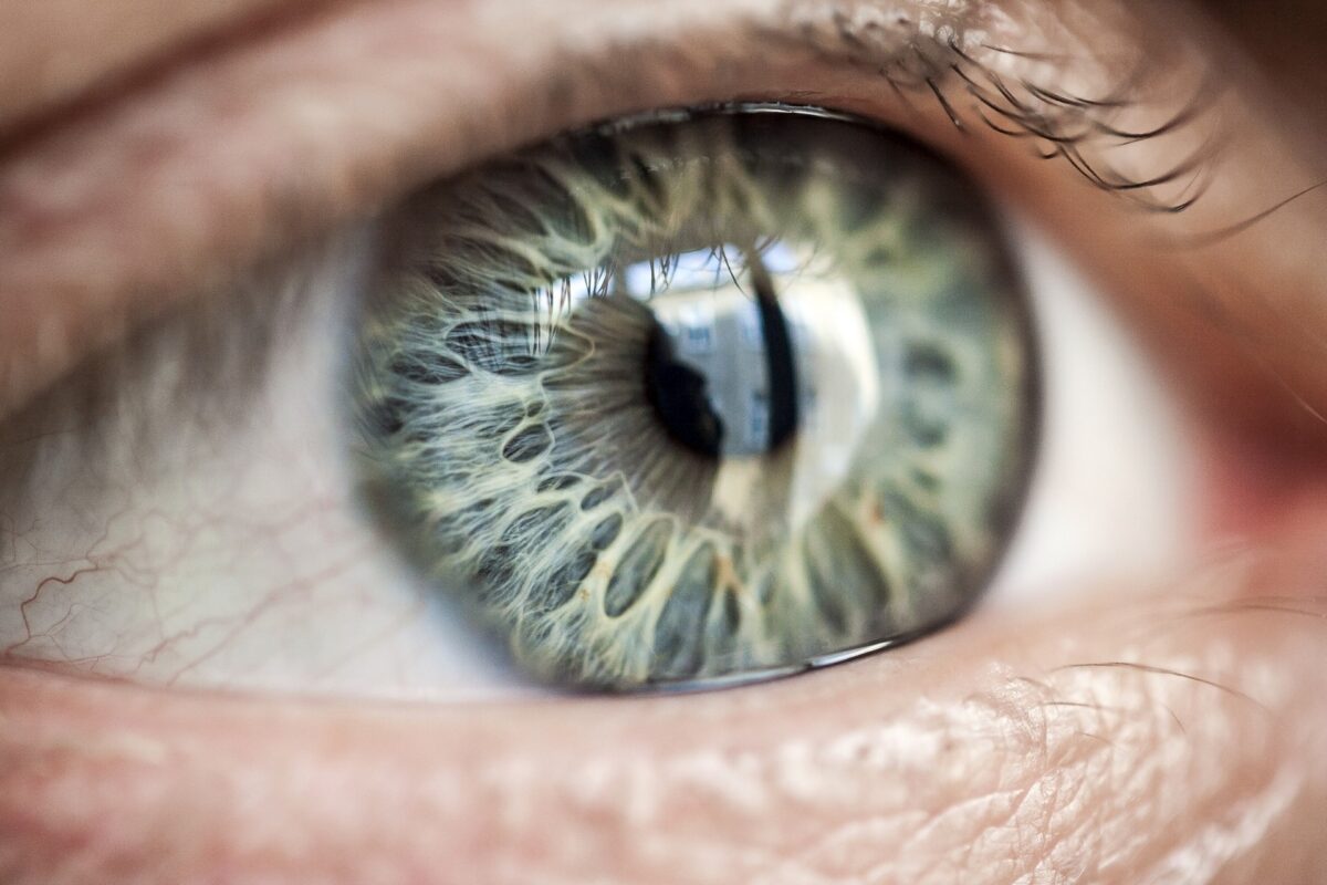 Human eye with very special patterned iris